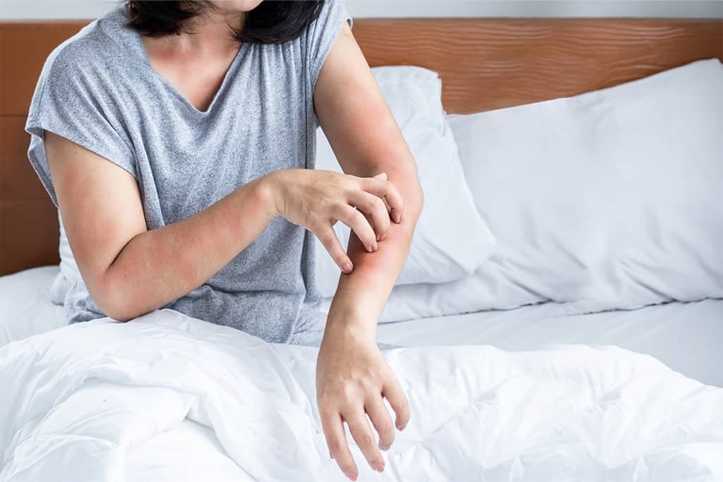 7 Early Signs of a Bed Bug Infestation